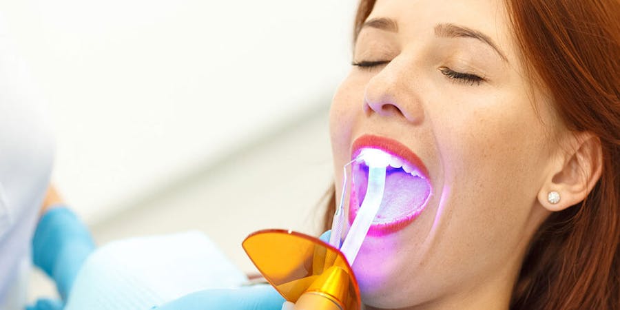 Dental Bonding Ajax